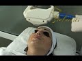 Nefertiti Lazeruli epilacia2.mpg