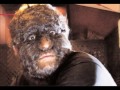 10 Strangest diseases of the universe