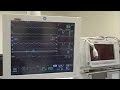 Bypass Surgery
