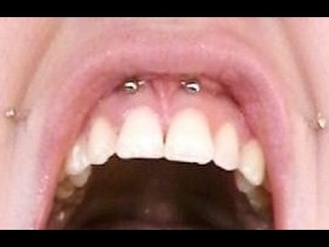 Gettin my SMILEY Pierced small smiley piercing. Gettin my SMILEY Pierced