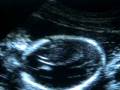 Ecografía Feto saludando con su manito-Fetal Ultrasound Greeting us with the hand