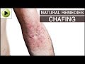 Skin Care - Chafing - Natural Ayurvedic Home Remedies 