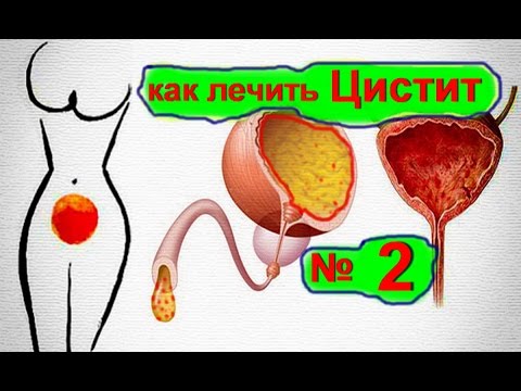 Как вылечить цистит в домашних условиях народными средствами