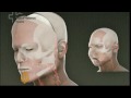 premiere implantation de visage complet