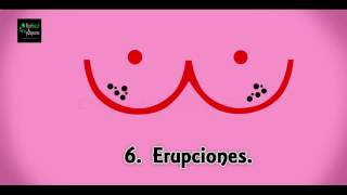 10 señales de alerta de cáncer de mama.