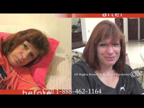 accutane attorneys southern california accutane attorneys southern california