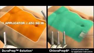 3M Releases Advanced Surgical Skin Prep Solution Aiding in Patient  Infection Prevention