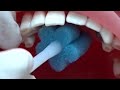 口腔ケアスポンジブラシの使い方の動画イメージ