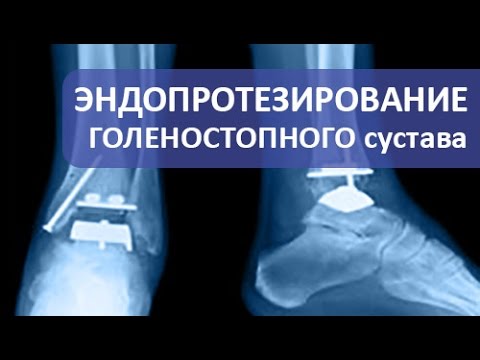 Грыжа межпозвоночных дисков у животных