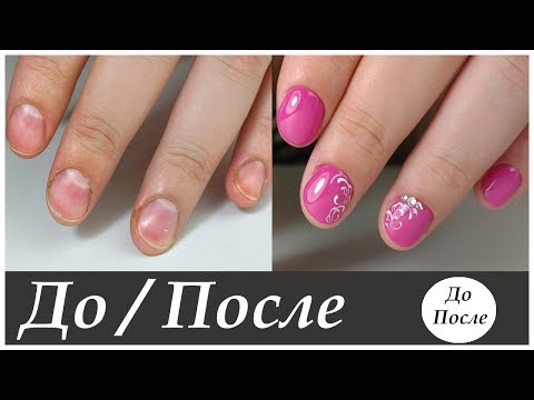 Народные методы для сжигания жира на животе Маски из банана для лица волшебные свойства домашних масок