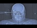25 Strangest Things Found In An X-Ray