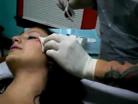 Getting my face pierced with a dermal anchor. It bleeds a lot afterwards. 