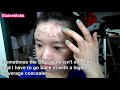 Acne Coverage Foundation Routine