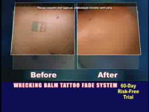 Wrecking Balm - Fade it. Remove it. Forg. 71. Laser Tattoo Removal
