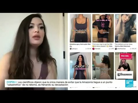 El Brazilian Butt Lift, la cirugía que se convirtió una peligrosa tendencia en redes sociales