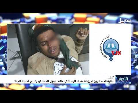 نقابة الصحفيين تدين الاعتداء الوحشي على الزميل الحمادي وتدعو لضبط الجناة