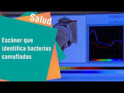 Escáner que identifica bacterias camufladas en los órganos | Salud
