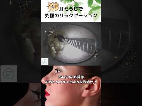 【衝撃】3年ぶりの耳掃除、左耳からサザエのような耳垢が！               #eariss  luana #イヤーエステ #耳掃除 #eariss #イヤーエステ #耳掃除 #耳かき動画