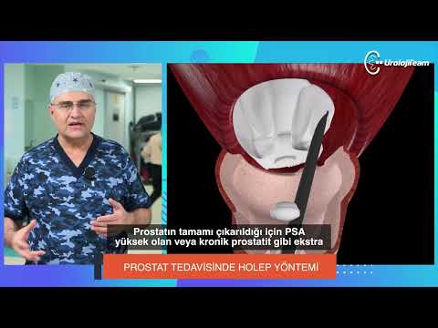 PROSTAT TEDAVİSİNDE HOLEP YÖNTEMİ