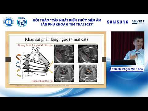20 mặt cắt tiếp cận siêu âm quý II thường quy theo ISUOG (ThS.BS. Phạm Minh Sơn)