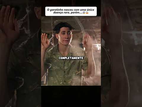 O garoto nasceu com uma doença rara #filmes #cenas #shorts #cinema