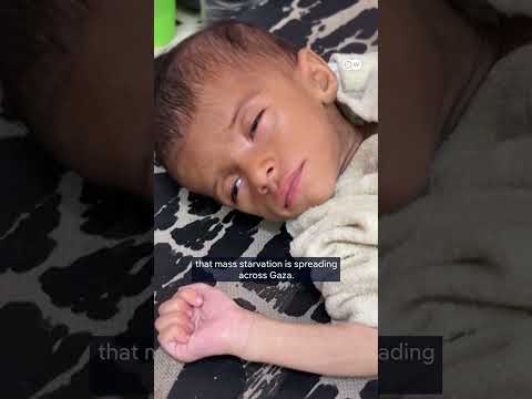 WHO: Palestinians in Gaza are suffering from "man-made" mass starvation | DW News