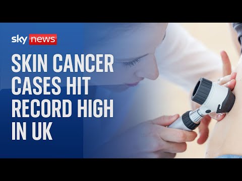 Melanoma skin cancer cases at all-time high in UK