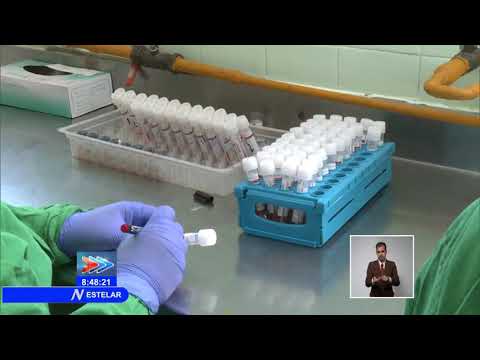 Cuba: Incrementa Centro de Higiene y Epidemiología procesamiento de muestras de PCR en La Habana