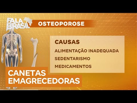 Canetas emagrecedoras: mulher desenvolve osteoporose e alerta sobre riscos