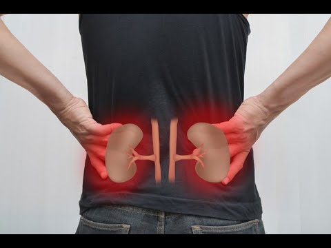 ¿Cómo tratar enfermedades relacionadas al riñón