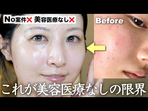【案件❌ほぼ3000円以下】美容医療なしで圧倒的美肌になった最新スキンケアルーティン全部見せます！