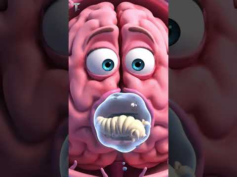 Đau Đầu, Co Giật? "Ấu Trùng Sán Não" Đang "Làm Tổ" Trong Não Bạn Đấy!