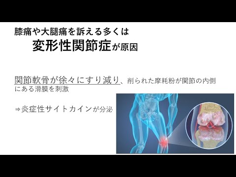 ひざ・股関節の痛み解消!【総合東京病院】