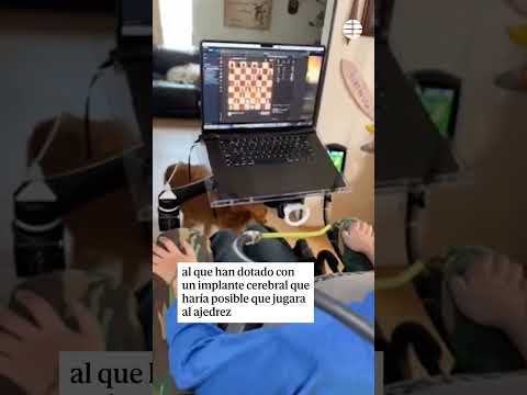 Neuralink, de Elon Musk, muestra a su paciente con un implante cerebral jugando al ajedrez