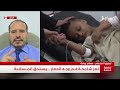 تغطية خاصة | تعز شامخة في وجه الحصار الإمامي .. صمود يستحق المساندة