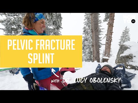 PELVIC FRACTURE SPLINT | HOW TO XV