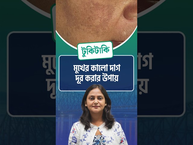Tukitaki : মুখের কালো দাগ দূর করার উপায় | Ways to remove dark spots on the face

#darkspots #facemask #healthylifestyle #tukitaki #drishtibhongi 



সব জায়গায় একই খবর দেখে দেখে বিরক্ত? চেনা খবর নতুন দৃষ্টিভঙ্গিতে পেতে সাবস্ক্রাইব করুন আমাদের চ্যানেল।

YouTube: https://www.youtube.com/channel/UCWrA...

Facebook: https://www.facebook.com/DrishtibhongiIN

Twitter: https://twitter.com/Drishtibhongi

Instagram: https://www.instagram.com/drishtibhongi
--------------------------------------------------------------------------------------------------












----------------------------------------------------------------------------------------
#Drishtibhongi #News #BreakingNews #Headline #Media #KolkataNews #BengaliNews #BanglaNews #NationalNews #WestBengal #Kolkata #NorthBengal #SouthBengal #Video #Videos #NewsVideos #BreakingNewsVideos #NewsBulletin #Bulletin #Khobor #BanglaKhobor #KhasKhobor #TatkaKhobor #TajaKhobor #WebPortal #WebNews #NewsPortal #Trinamool #BJP #CPIM #Congress #Politics #Entertainment