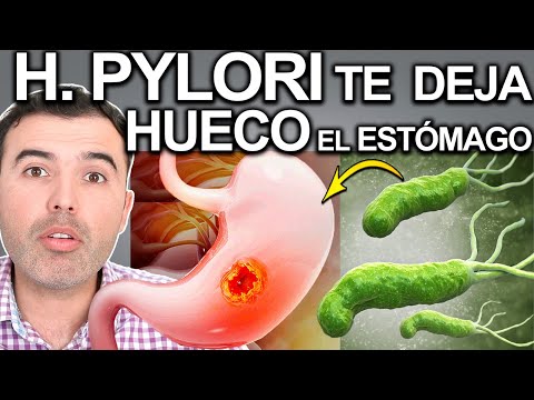 ALERTA! - LA HELICOBACTER PUEDE ROMPER TU ESTOMAGO