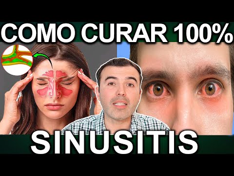 COMO CURAR LA SINUSITIS - Como Eliminar Los Mocos Limpiar Y Desinflamar Tu Sinusitis