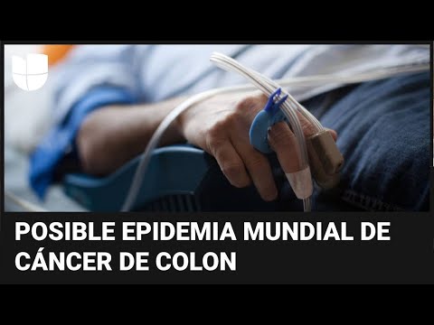 Alerta por aumento de casos de cáncer de colon entre menores de 50 años: estos son los síntomas