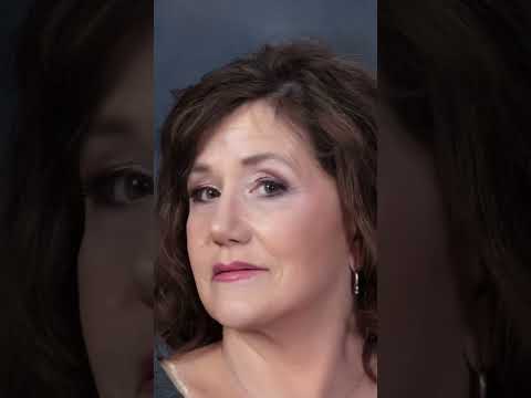 Facelift Before & After - Dr. Tanveer Janjua