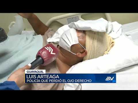 Policía pierde su ojo derecho tras riña en una cárcel de Guayaquil