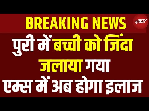 Odisha News: पुरी में बच्ची को जलाने का मामला, Delhi AIIMS में होगा इलाज | BREAKING NEWS