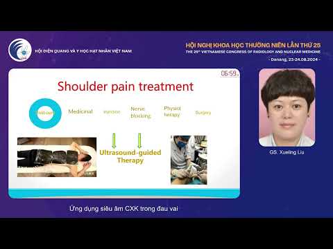 3. Ứng dụng siêu âm cơ xương khớp trong đau vai (GS. Xueling Liu)