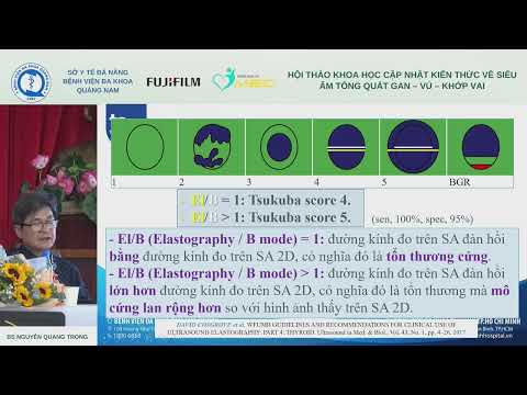 [S] Siêu âm tuyến vú đa thông số (BS Nguyễn Quang Trọng)