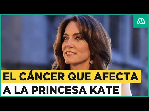 Kate Middleton revela que tiene cáncer: Princesa de Gales está con quimioterapia