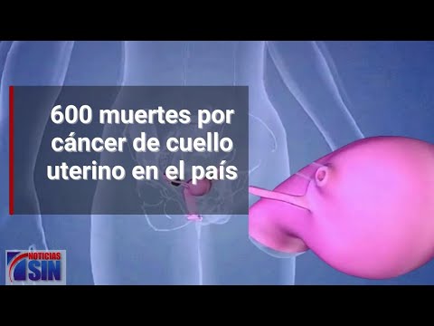 600 muertes por cáncer de cuello uterino en el país