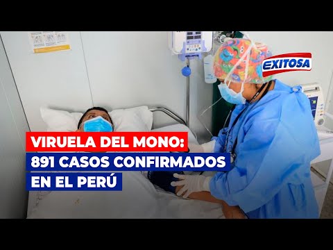 INS sobre más de 800 casos de viruela del mono en el Perú: Hay una alta transmisión comunitaria