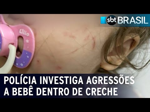 RJ: Polícia investiga agressões a bebê dentro de creche na Rocinha | SBT Brasil (26/02/24)