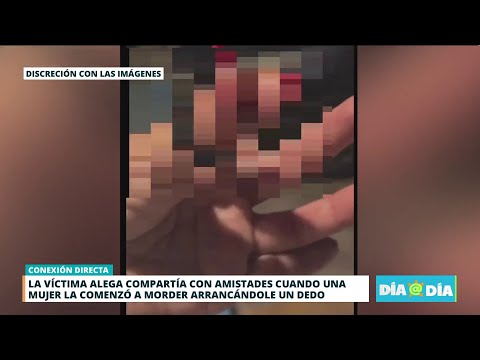 Mujer le arranca dedo a otra durante pelea en negocio de San lorenzo